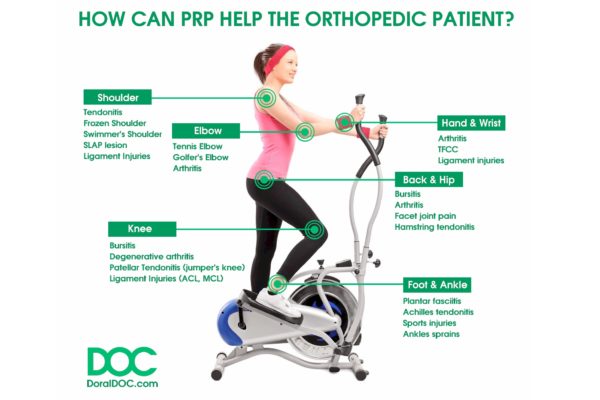 Benefits of PRP For Orthopedic Patients